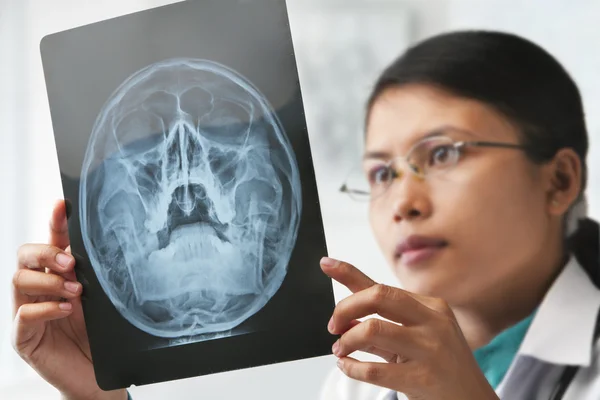 Mujer médico comprobación de imagen de rayos X —  Fotos de Stock