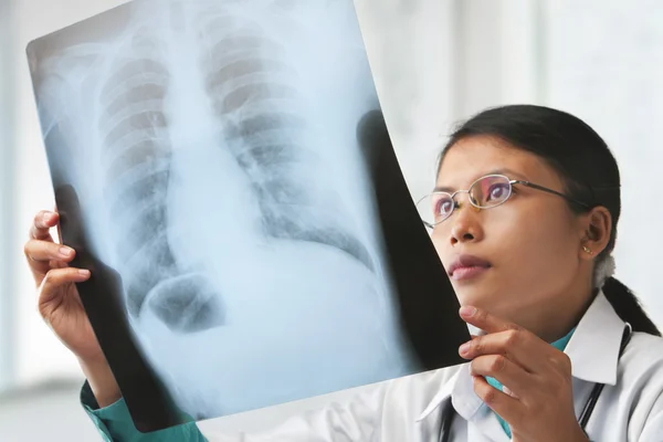 Médico feminino verificando imagem de raio-x — Fotografia de Stock