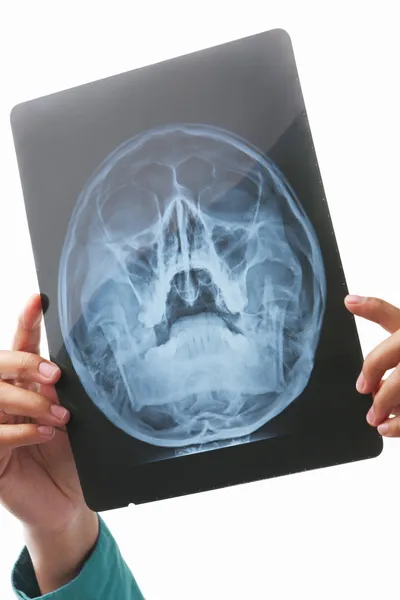 Hand met xray beeld van schedel gebied — Stockfoto