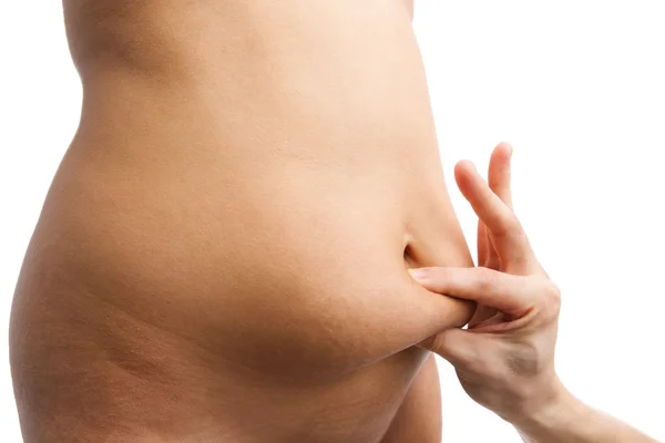 Hand pinching fat on female belly — Stock Photo, Image