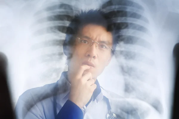 Азиатский врач изучает рентген отрицательный — стоковое фото