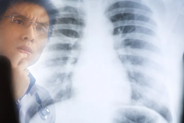 Asian doctor examining xray negative — Stock Photo, Image