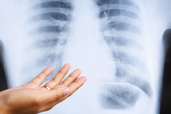 Доктор Рука объясняет на рентгене отпечаток — стоковое фото