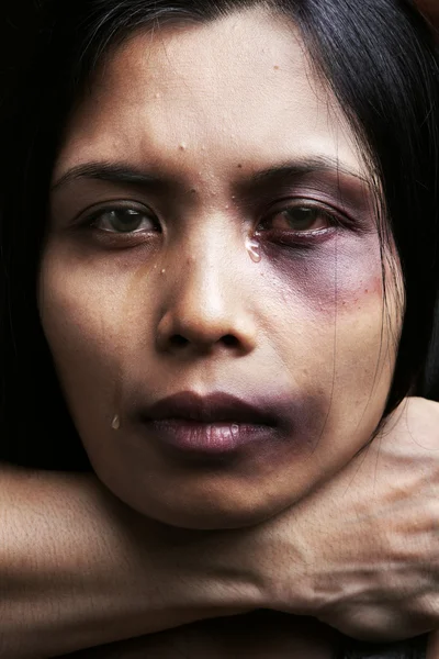 女人被一身行头和伤害 — 图库照片