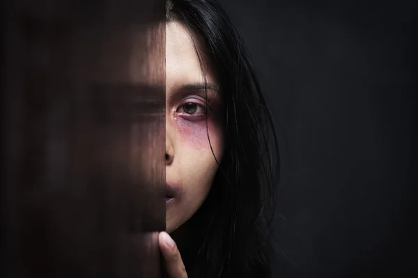 Mulher ferida escondida no escuro — Fotografia de Stock