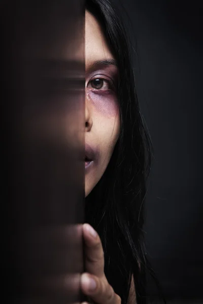 Mujer herida escondida en la oscuridad — Foto de Stock