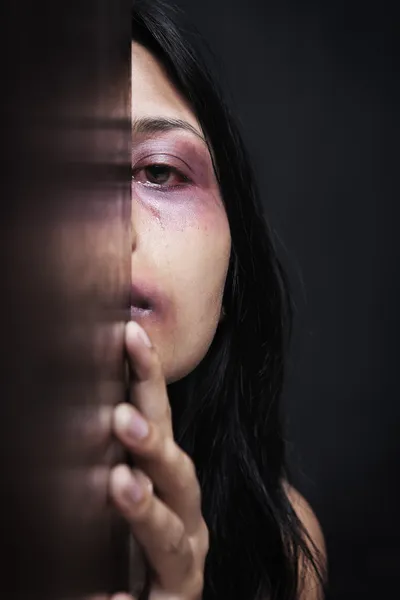 Mulher ferida escondida no escuro — Fotografia de Stock
