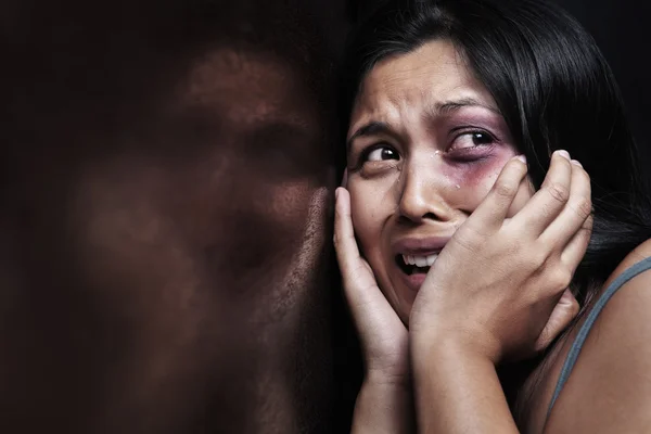 Mujer herida aterrorizada — Foto de Stock
