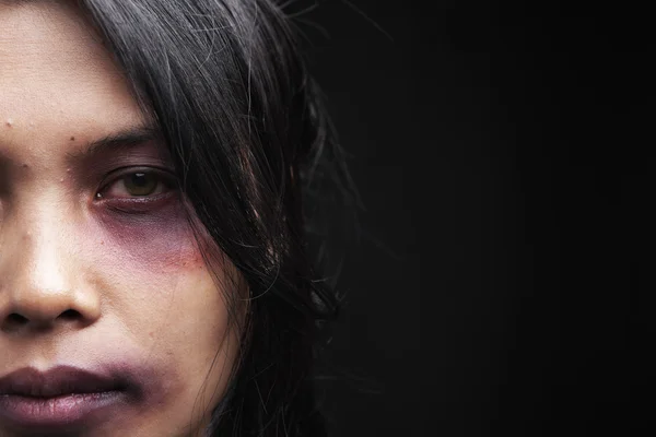 Opfer häuslicher Gewalt Stockbild