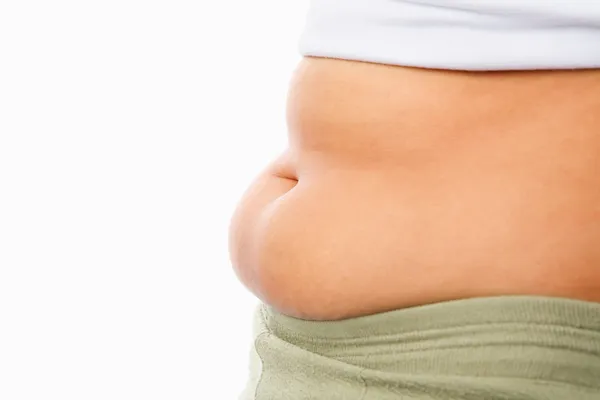 Brzuch tłuszczu dla otyłych koncepcja — Zdjęcie stockowe