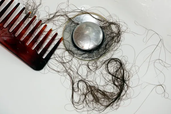 Perda de cabelo depois de lavar a cabeça — Fotografia de Stock