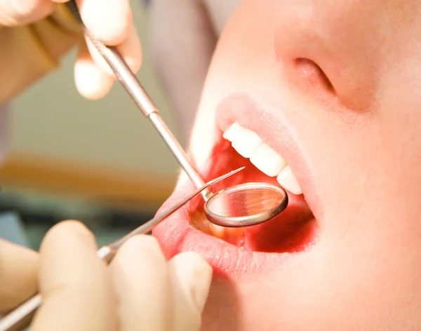 Boca abierta femenina durante la inspección oral con espejo y gancho — Foto de Stock
