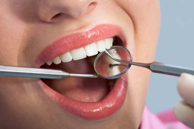 hastalar daha önce oral muayene ağzı açık
