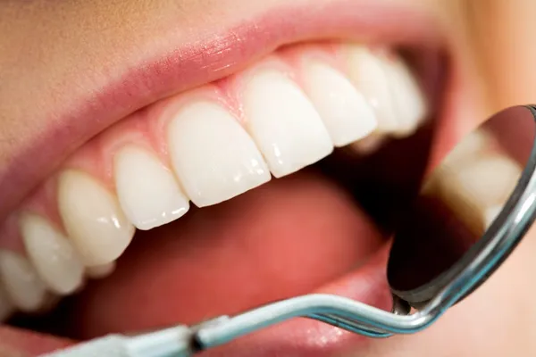 歯の検査 — ストック写真