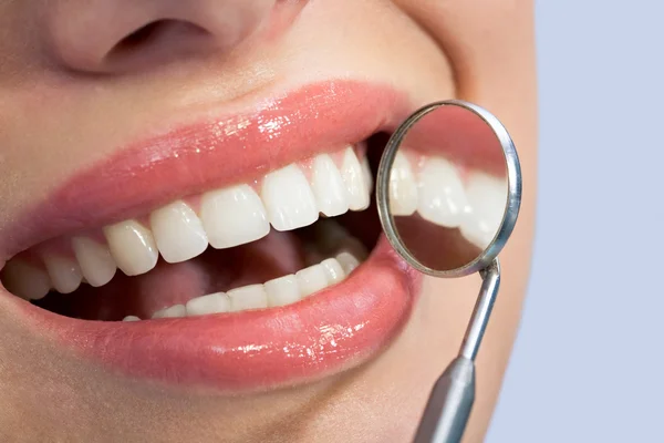 Patients open mouth before oral inspection — Stock Photo, Image