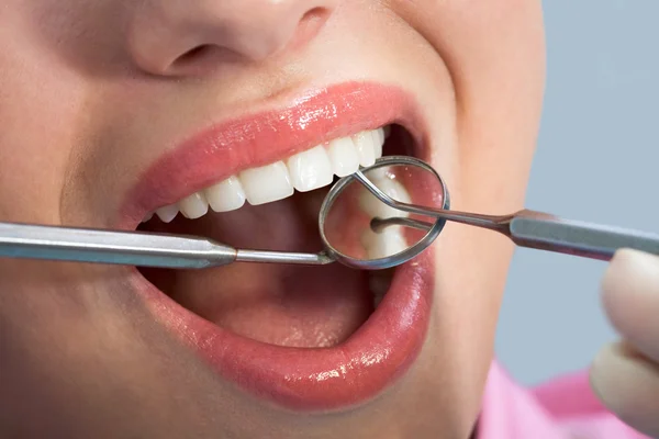 Пациенты открывают рот перед оральным обследованием — стоковое фото