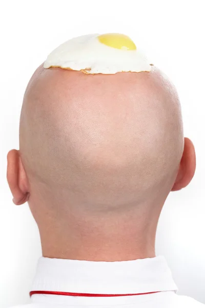 Widok z tyłu głowy łysy mężczyzna z jajka sadzone na to — Zdjęcie stockowe