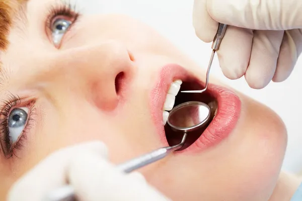 Badanie jamy ustnej — Zdjęcie stockowe