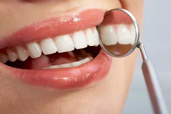 Close-up of patient's open mouth — Stock Photo, Image