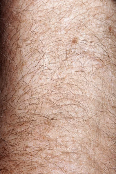 Close-up of human skin and hair on arm — Stock Photo, Image