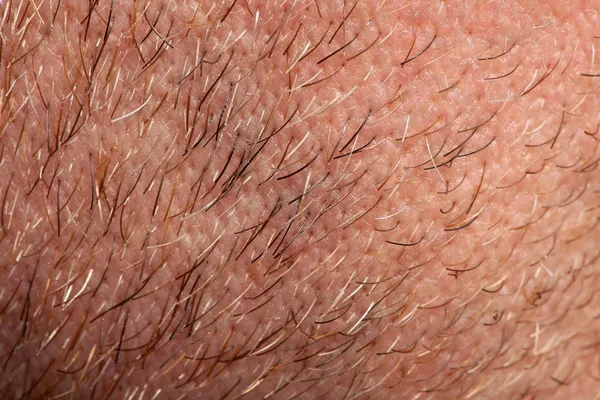 Close-up of human skin and hair on neck — Stock Photo, Image