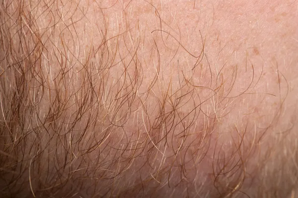 Close-up of human skin with hair — Stok Foto