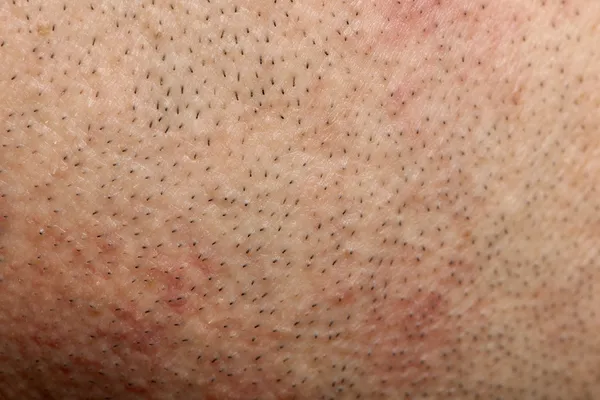 Close-up of human skin — Stock Photo, Image