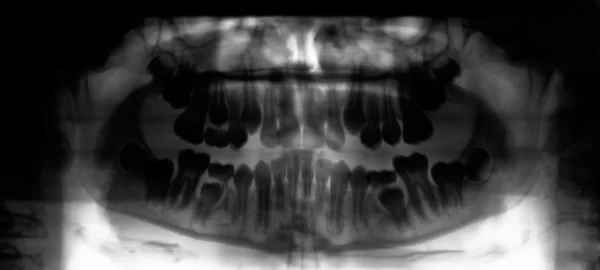 Рентген челюстной кости человека — стоковое фото