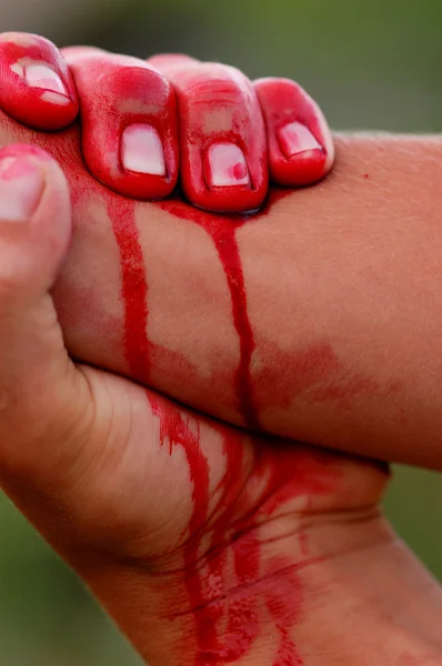 Bleeding hand — Stock Photo, Image