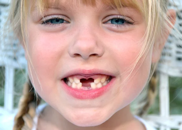 Diş sırıtış — Stok fotoğraf