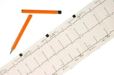 Stress! Fast ecg trace with snapped pencil clipart