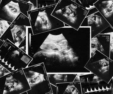 Baby on an ultrasound image clipart