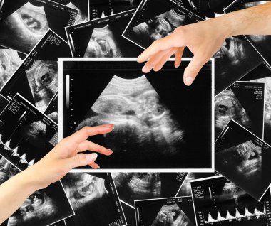 Baby on ultrasound image clipart