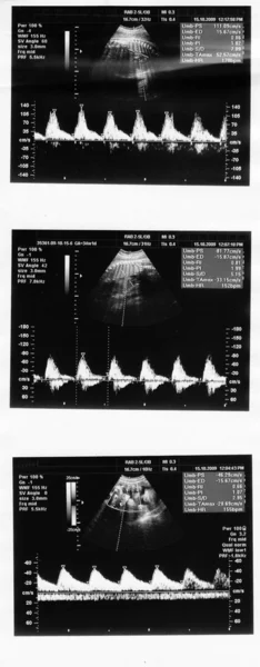 Kind im Bild Ultraschall — Stockfoto