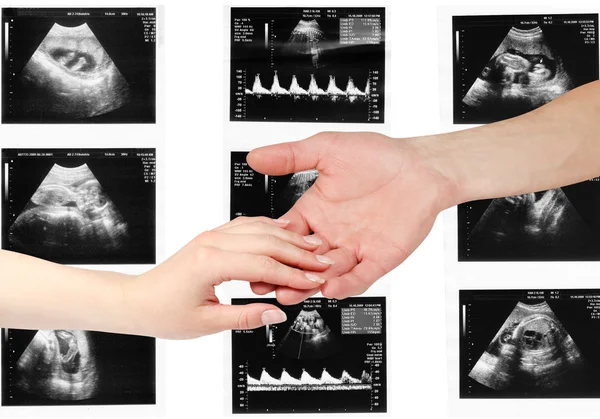 Zwei Arme von Liebenden und das Kind auf dem Bild Ultraschall — Stockfoto