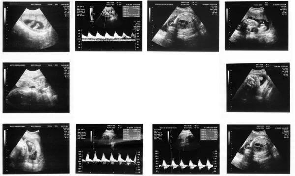 Çocuk resim ultrason — Stok fotoğraf