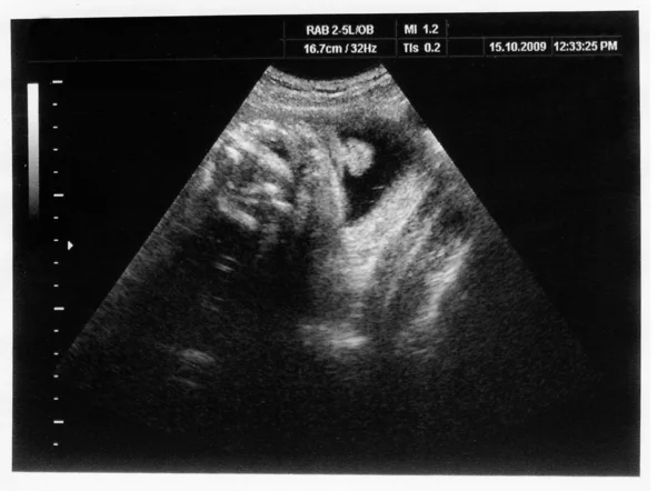 Dziecko w USG obraz — Zdjęcie stockowe