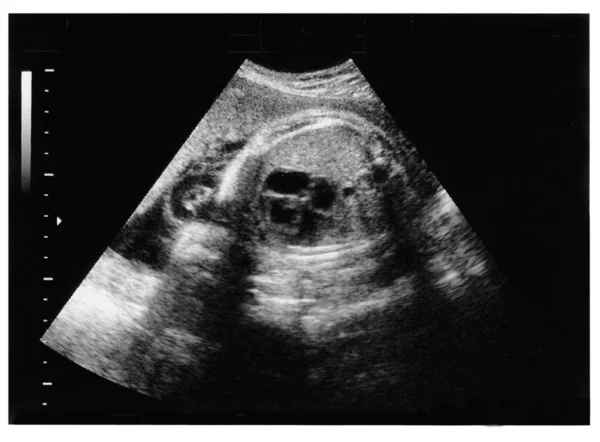Lapsi kuvassa ultraääni — kuvapankkivalokuva