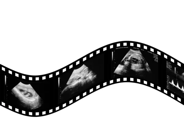 Dítě v obrázek ultrazvuk — Stock fotografie