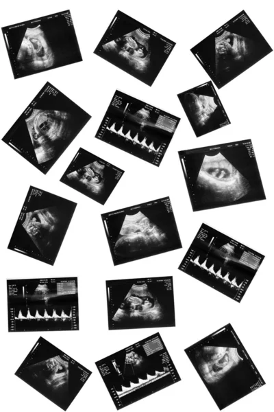 Barn i bild-ultraljud — Stockfoto