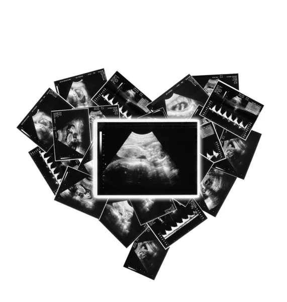 超音波画像の赤ちゃん — ストック写真