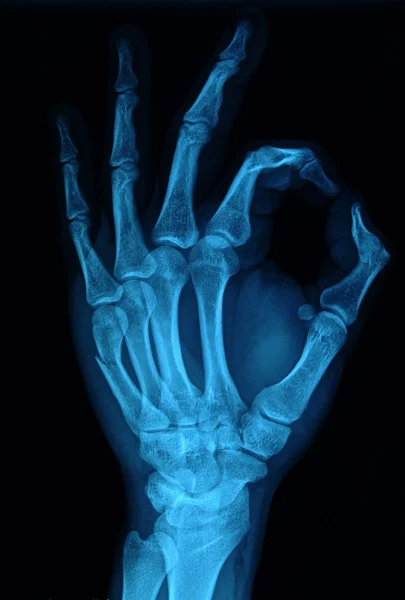 Hand-Röntgen — Stockfoto
