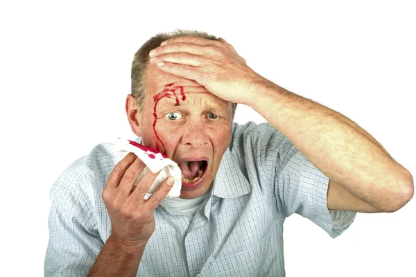 Verwundeter Mann mit blutüberströmtem Gesicht — Stockfoto