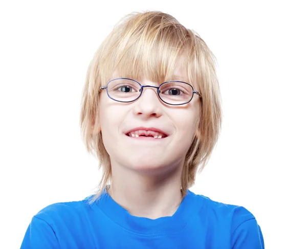 Chłopiec wyświetlone brakujących zębów mlecznych — Zdjęcie stockowe
