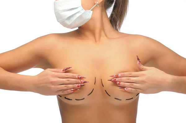 Zbliżenie fotografia kaukaski kobieta piersi oznaczone linie do piersi modyfikacja maski medyczne Obrazek Stockowy