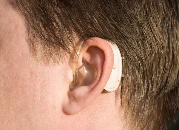 Gros plan d'une oreille d'homme avec un appareil auditif derrière l'oreille — Photo