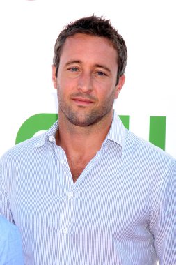 Alex O'Loughlin