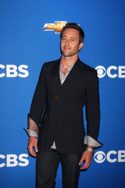 Alex O'Loughlin