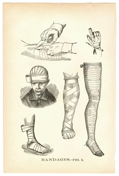 Illustrations of bandaged injuries from a vintage medical book — Stock Photo, Image