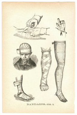 Illustrations of bandaged injuries from a vintage medical book clipart